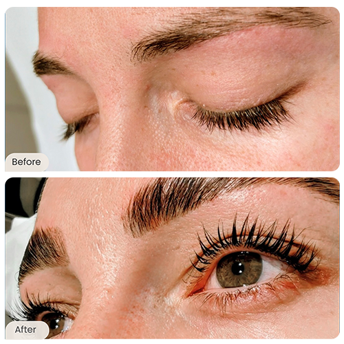 Before and After - 44