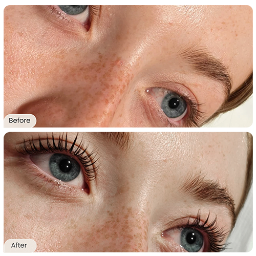 Before and After - ‏55